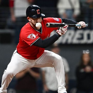 Guardians’ David Fry has broken nose, facial fractures from HBP