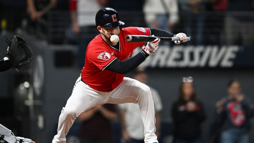 Guardians’ David Fry has broken nose, facial fractures from HBP