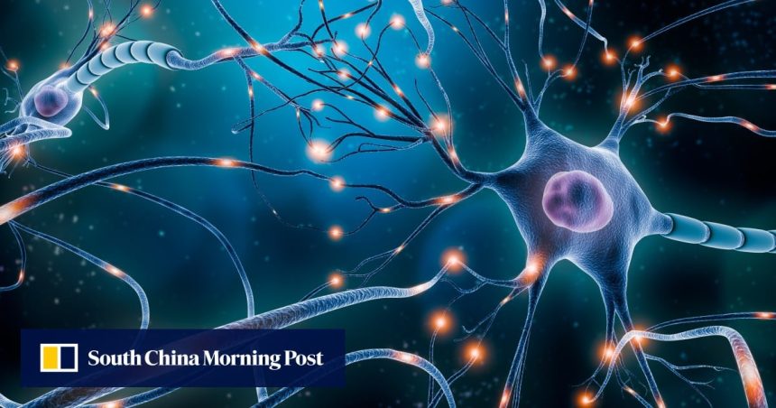 UK scientists slow Huntington’s disease for first time
