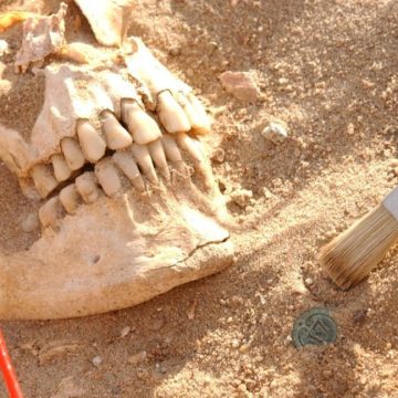 DNA analysis reveals likely pathogens that killed Napoleon’s army Skull of a soldier from the Napoleon army next to a button from a soldier's uniform.