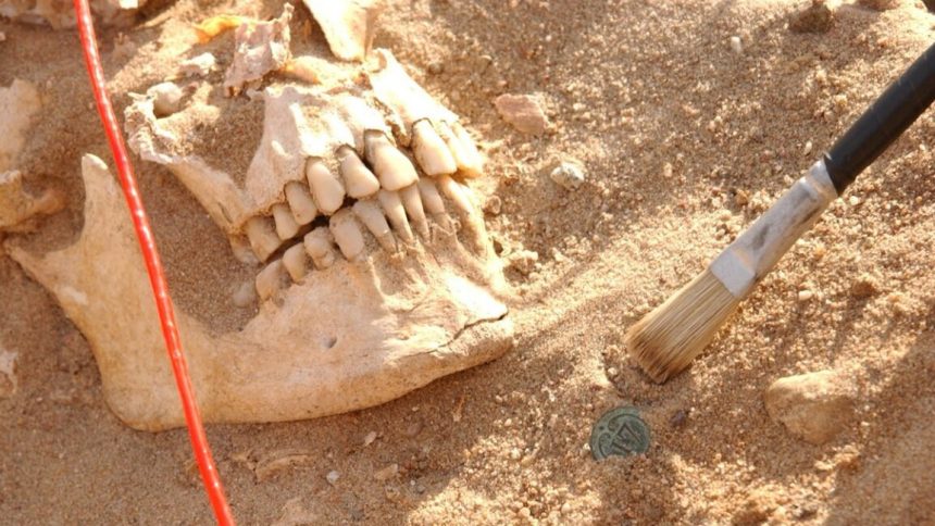 DNA analysis reveals likely pathogens that killed Napoleon’s army Skull of a soldier from the Napoleon army next to a button from a soldier's uniform.