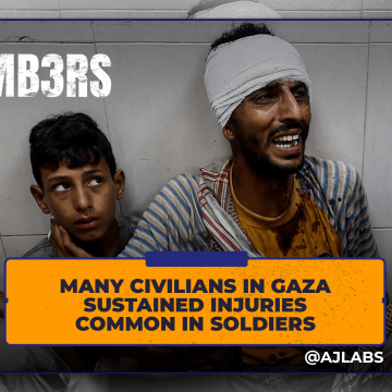 Many civilians in Gaza sustained injuries common in soldiers