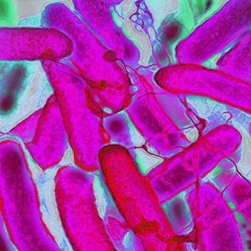 Resistant Bacteria Are Advancing Faster Than Antibiotics