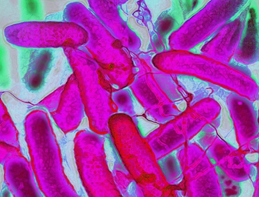Resistant Bacteria Are Advancing Faster Than Antibiotics