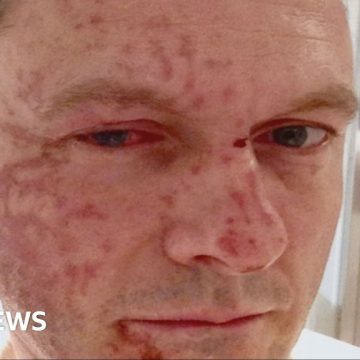 Scottish Conservative leader's acid attacker denied parole