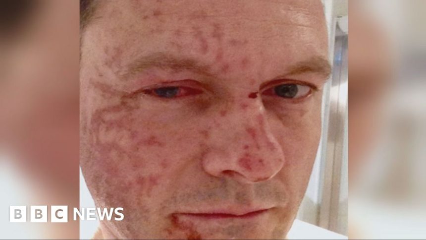 Scottish Conservative leader's acid attacker denied parole