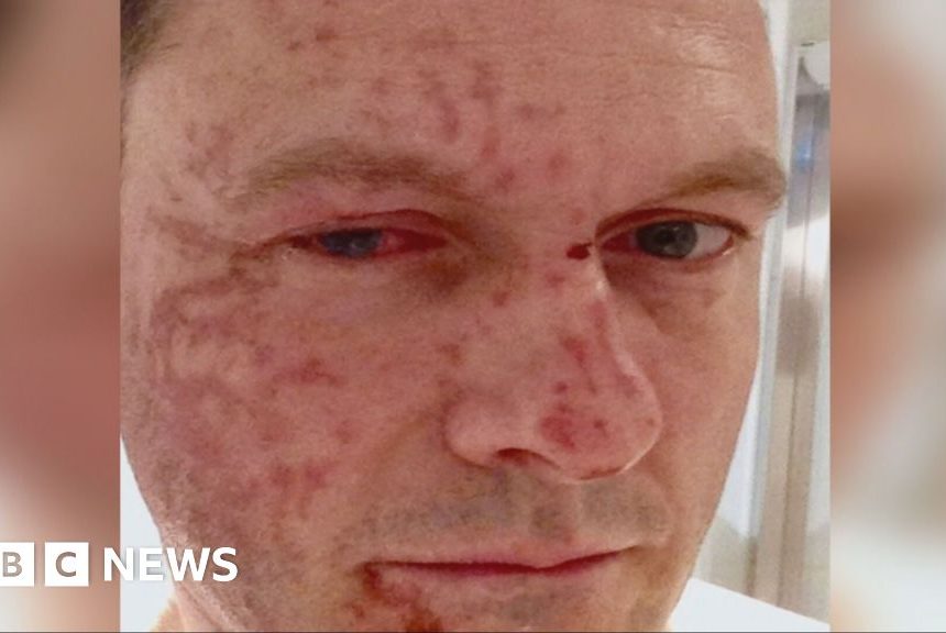 Scottish Conservative leader's acid attacker denied parole