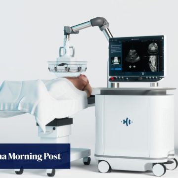 Li Ka-shing-backed focused ultrasound therapy reaches ‘tipping point’ with 1 million cases