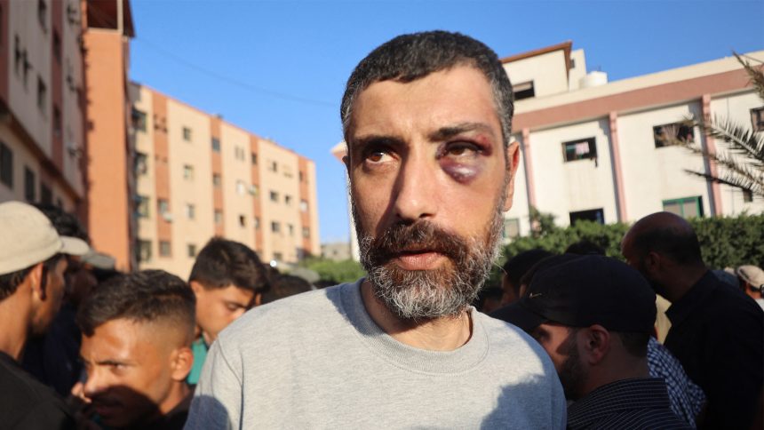 Freed Palestinian detainees allege torture in Israeli jail | Gaza