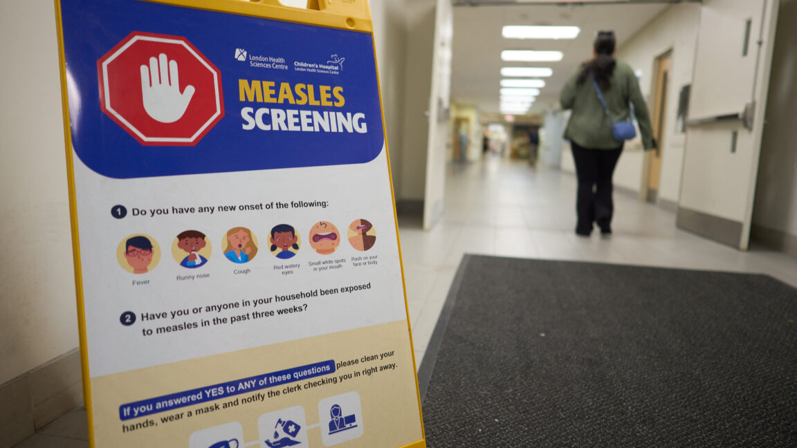 A person walks past a measles screening sign near an entrance at Victoria Hospital in London, Ontario, on July 9, 2025.