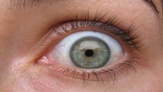 Four-inch worm hatches in woman’s forehead, wriggles to her eyelid